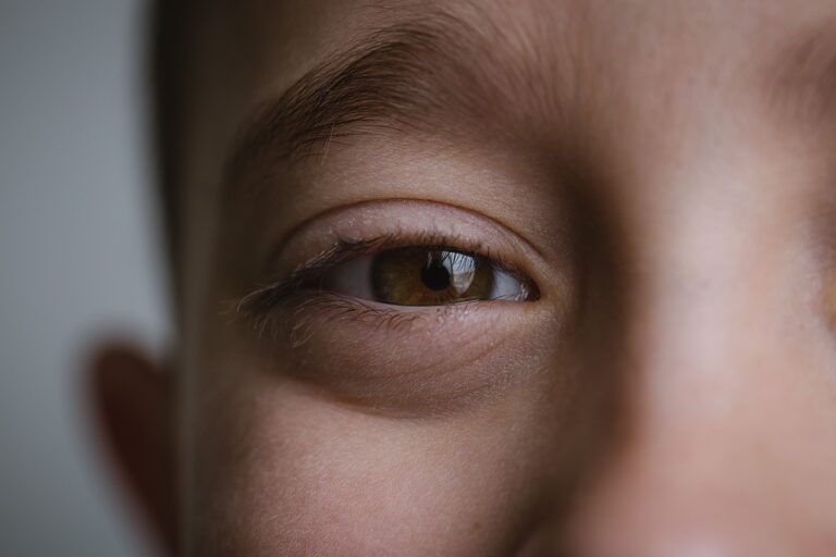 子どもが花粉症で目薬を忘れた時はどうする？