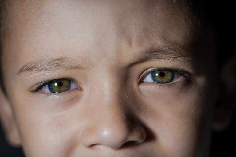 子どもの花粉症で目の充血を冷やすと温める、どちらが効果的？